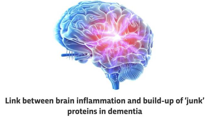 Silencil benefits
